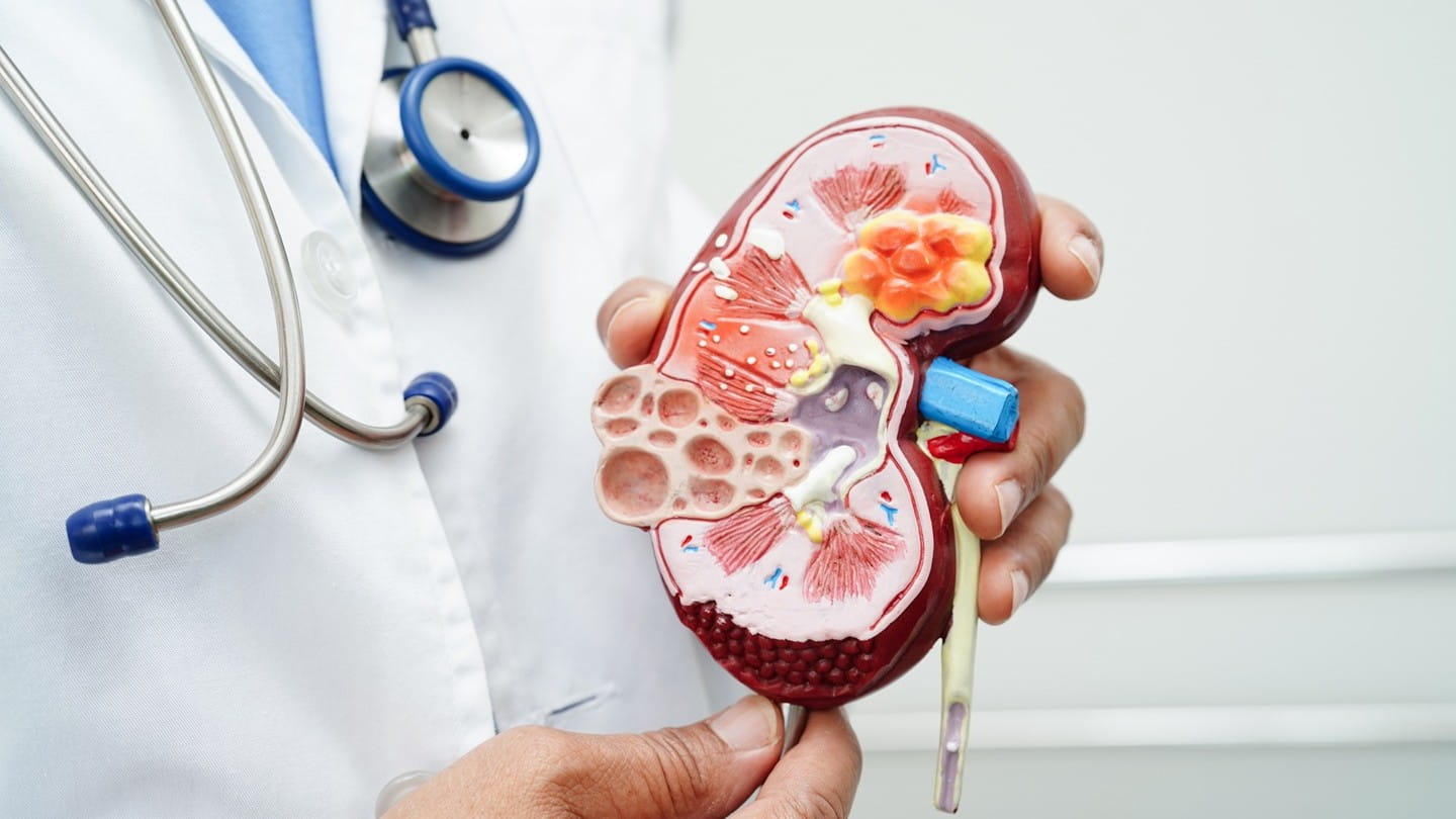 El Hospital Universitario Rey Juan Carlos detectó 45 nuevos casos de enfermedad renal crónica en 2025 gracias al programa pionero de cribado PreveRenal